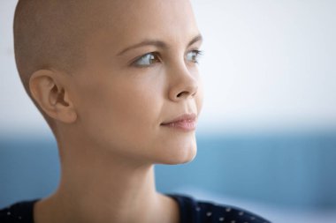 Güçlü bir milenyum kadın kanser hastası geleceğe umutla bakıyor