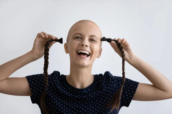 Positivo malato femmina guardando fotocamera ridere quando si perdono i capelli — Foto Stock