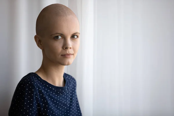 Courage young woman fighting against cancer disease standing by window — Stock Photo, Image