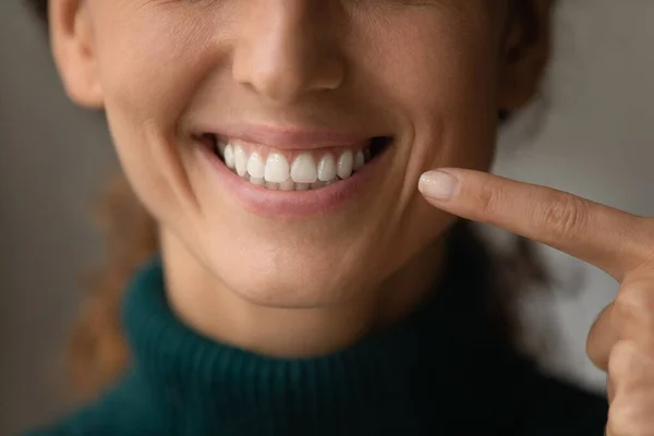 Close up of woman demonstrate white healthy teeth — Stock Photo, Image