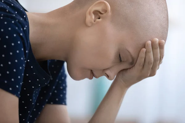 Sconvolto donna senza peli cancro paziente si sentono depressi — Foto Stock