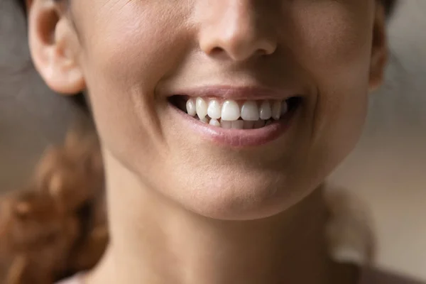 Millennial donna soddisfatto paziente clinica dentale dimostrare affascinante sorriso sano — Foto Stock