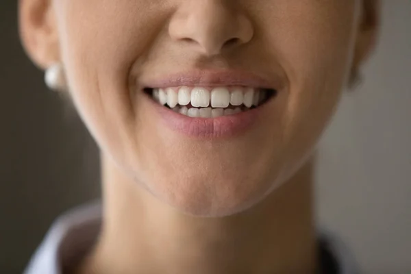 Parte inferior de la cara de mujer joven con encantadora sonrisa saludable —  Fotos de Stock