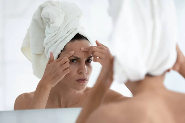 Sérieuse fille millénaire préoccupée par problème de peau du visage — Photo