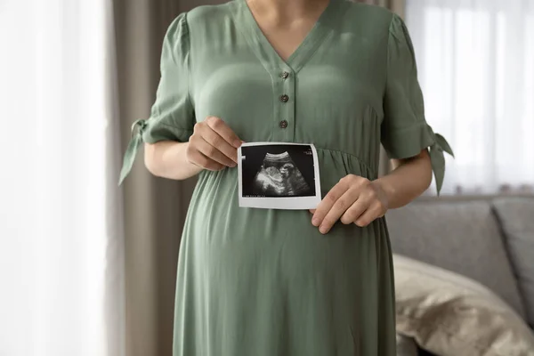 Zblízka oříznuté těhotné ženy v šatech ukazující ultrazvuk obrázek — Stock fotografie