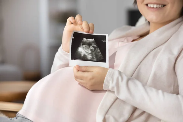 Detailní sestřih usměvavé těhotné ženy ukazující ultrazvuk — Stock fotografie