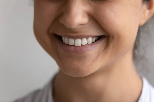 Primer plano de la sonriente mujer india mostrar los dientes blancos sanos — Foto de Stock