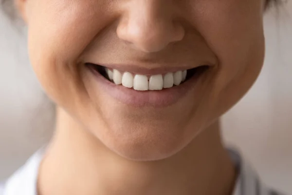 Close up cropped of Indian woman healthy toothy beaming smile — Foto Stock