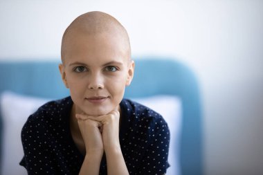 Kanser savaşından ilham alan mutlu, genç, tüysüz kadın..