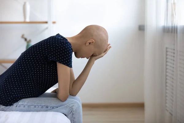Депрессивный молодой лысый рак больной женщиной чувствует себя нездоровым. — стоковое фото