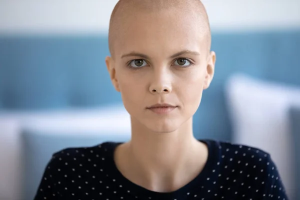 Portret van ernstige duizendjarige haarloze na chemotherapie vrouw. — Stockfoto