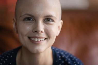 Kanserli mutlu hasta kadın kemoterapiden iyi sonuç alıyor.