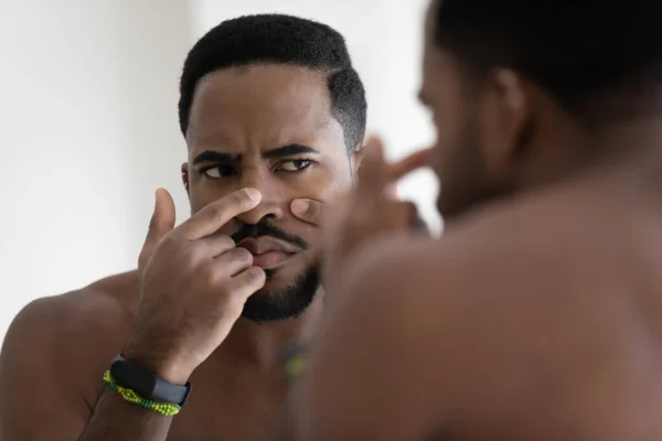 Afrikansk kille tittar i spegel beröring ansikte klämmer finne — Stockfoto