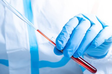 Kanla çalışan doktor ya da bilim adamlarının Macro 'su. Covid 19 kan testi konsepti. Cam boru ve tüp. Coronavirus varyant testi. Yeni virüs türü mutasyon araştırması ve keşfi.