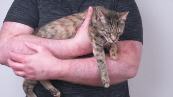 这家伙抱着一只小猫 抓着他的手 上面沾满了银屑病 银屑病 湿疹和其他皮肤干燥的疾病 — 图库视频影像