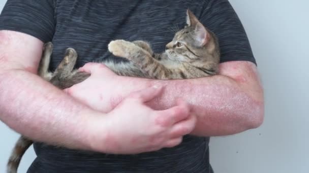 这家伙抱着一只小猫 抓着他的手 上面沾满了银屑病 银屑病 湿疹和其他皮肤干燥的疾病 — 图库视频影像