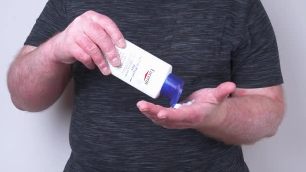 Guy Smears His Hands Ointment His Hands Covered Psoriasis Which — Stock Video