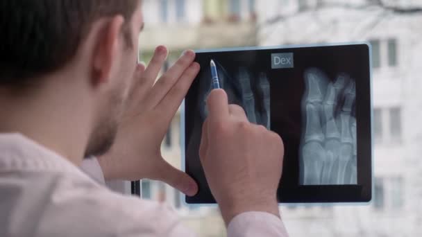 Junger Arzt Beim Betrachten Eines Röntgenbildes Vor Dem Hintergrund Eines — Stockvideo