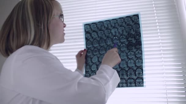 Sebész megvizsgálja röntgen — Stock videók