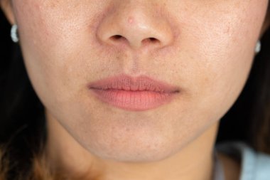 Kapalı kadın ağzı, kız dudağı, Asyalı kadın