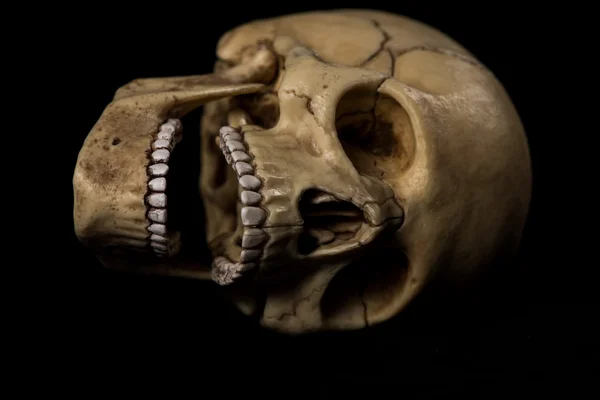 Calavera humana. mandíbula — Foto de Stock