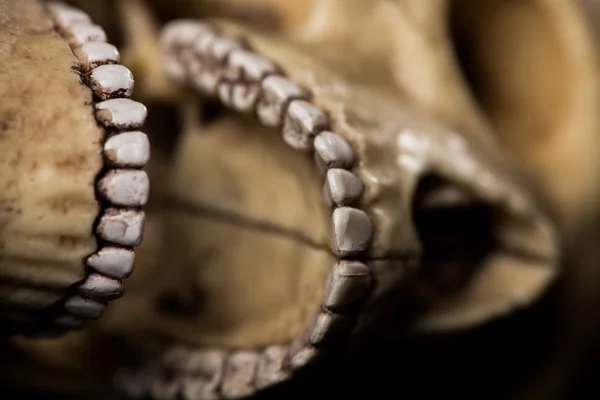 Calavera humana. mandíbula — Foto de Stock