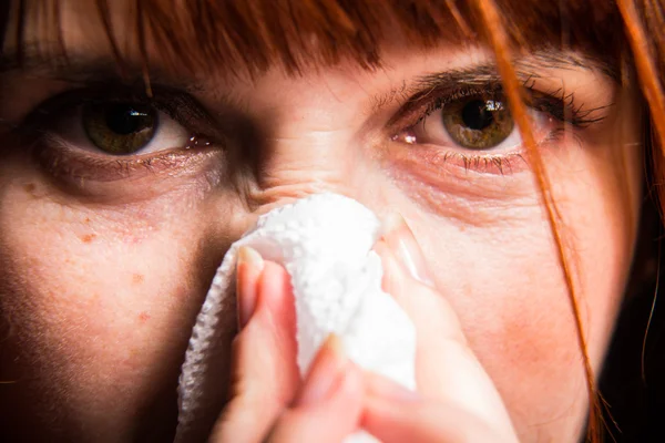 Erkältung. Mädchen vysmarkivatsya Taschentuch — Stockfoto