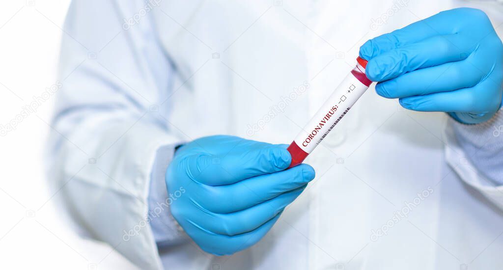 Doctor holding a test blood sample tube positive with strain COVID-19
