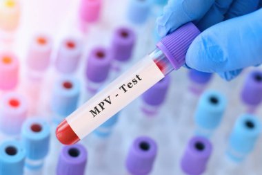 Hand with medical glove of doctor holds test tube with blood sample and blank label for own text on the background of medical test tubes.