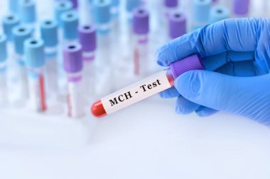 MCH testi ile kan örneği tüpü tutan doktor, anemi teşhisi için korusküler hemoglobin analizi, hemoglobin konsantrasyonu değerlendirmesi ve kırmızı kan hücresi sağlık değerlendirmesi, kopyalama alanı