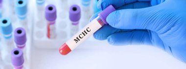 MCHC testi ile kan örneği tüpü tutan doktor, anemi teşhisi için korusküler hemoglobin konsantrasyon analizi, kırmızı kan hücresi kalite değerlendirmesi ve hemoglobin doygunluk değerlendirmesi, kopyalama alanı