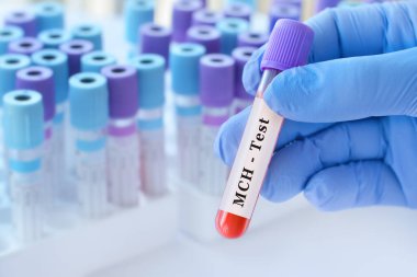 MCH testi ile kan örneği tüpü tutan doktor, anemi teşhisi için korusküler hemoglobin analizi, hemoglobin konsantrasyonu değerlendirmesi ve kırmızı kan hücresi sağlık değerlendirmesi, kopyalama alanı