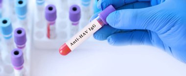 Elinde antiHAV IgG kan testi tüpü bulunan doktor Hepatit A 'ya uzun süreli bağışıklık, geçmiş enfeksiyon ya da klinik laboratuvar teşhislerinde aşı durumu değerlendirmesini açıklıyor.