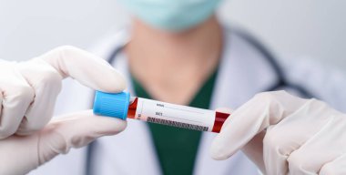 Yeşil koruyucu ekipmanlı doktor ve yüz maskesi takan eldivenler giyip beyaz arka planda kan tüpü tutuyor..