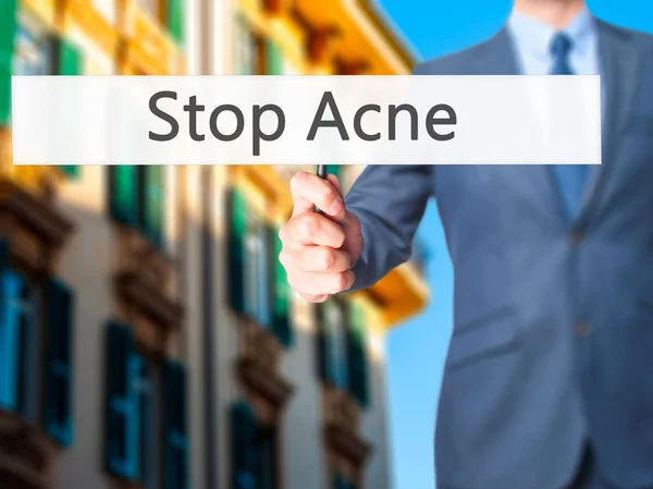 Stop Acne - Businessman hand holding sign — Stock Photo, Image