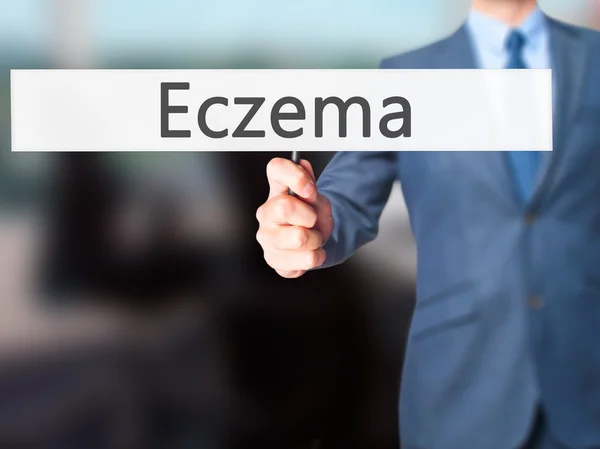 Eczema - Empresario mano sosteniendo cartel — Foto de Stock