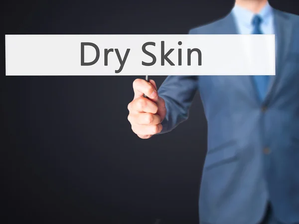 Dry Skin - Businessman hand holding sign — Stock Photo, Image