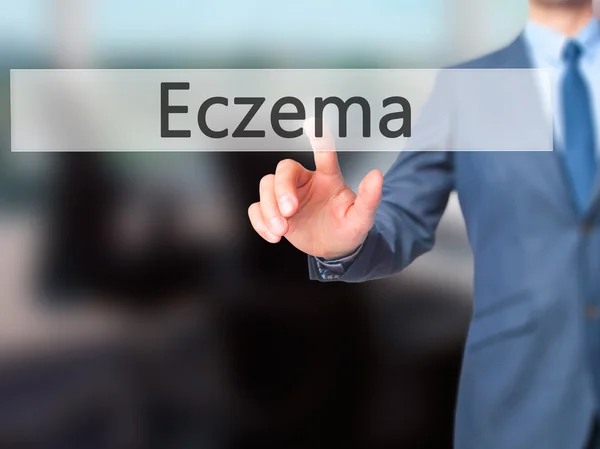 Eczema - Empresario pulsación de la mano botón en la pantalla táctil interf — Foto de Stock