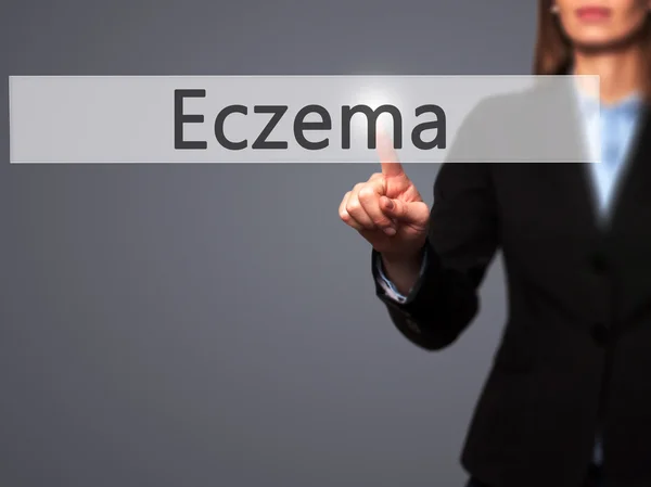 Eczema - Empresaria pulsar el botón de mano en la pantalla táctil inte — Foto de Stock