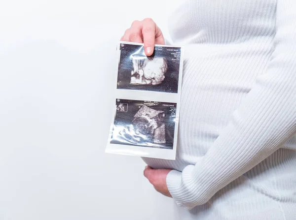 Gran Vientre Mujer Embarazada Sosteniendo Película Ultrasonido Estómago Con Cara — Foto de Stock