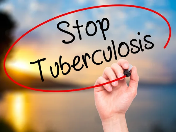 Man Hand schrijven van Stop tuberculose met zwarte marker op visuele s — Stockfoto
