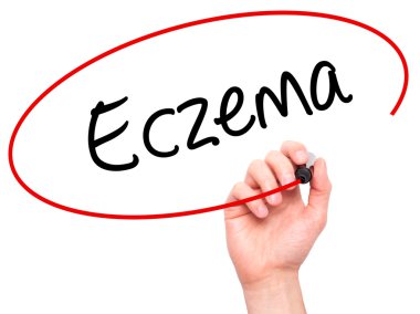 Man Hand writing Eczema with black marker on visual screen clipart