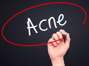 Adam el akne ile siyah kalemi görsel ekranda yazma.