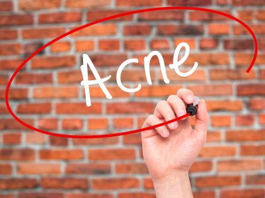 Adam el akne ile siyah kalemi görsel ekranda yazma.