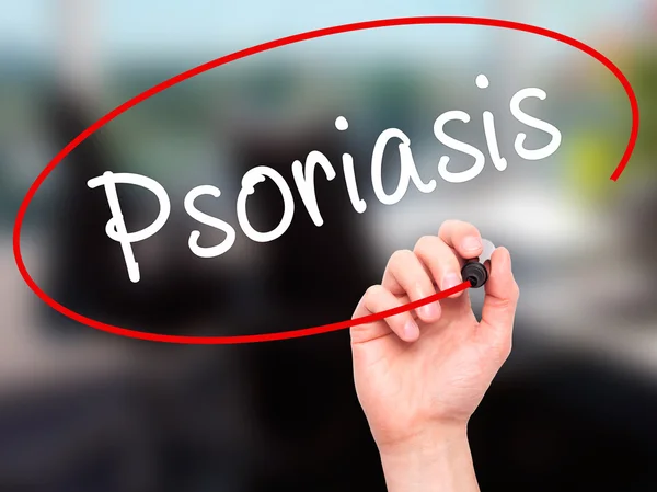 Man Hand skriver Psoriasis med svart markering på visuella skärm — Stockfoto