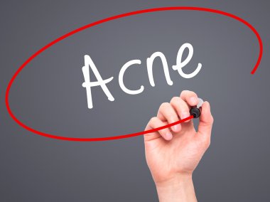 Adam el akne ile siyah kalemi görsel ekranda yazma.