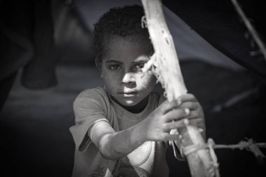 Taiz _ Yemen _ 09 Şubat 2017: Evinden uzaklaştırılan Yemen 'li bir çocuk, o ve ailesi Taiz kentinde devam eden savaş nedeniyle açık alanda yaşıyor.