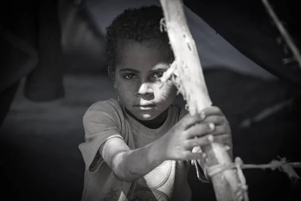 Taiz Yemen Feb 2017 Yemeni Child Saddened Displacement His Home — Stock Photo, Image