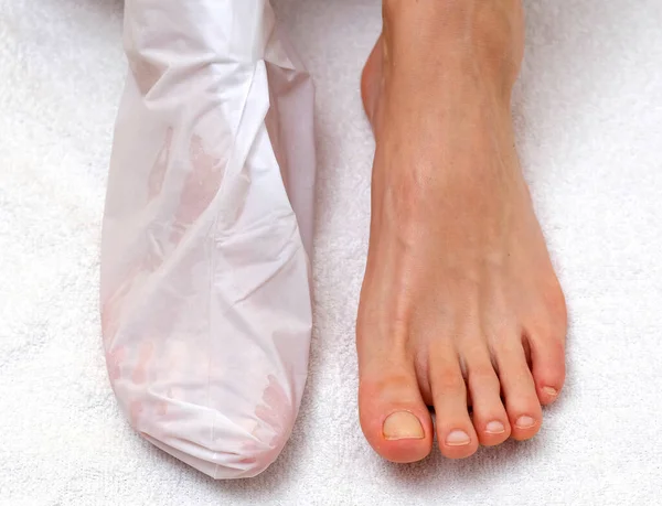 Sock-mask for feet on a female leg, white towel background Stock Photo