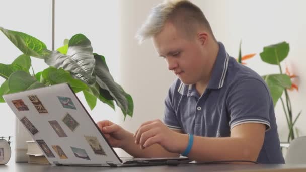 Down sendromlu mavi saçlı genç çocuk dizüstü bilgisayarla çalışıyor. — Stok video
